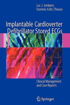portada implantable cardioverter defibrillator stored ecgs: clinical management and case reports (en Inglés)