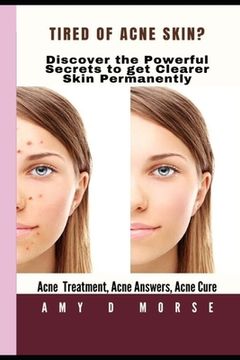 portada TIRED OF ACNE SKIN? Discover the Powerful Secrets to get clearer skin Permanently (en Inglés)