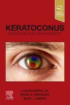portada Keratoconus: Diagnosis and Management (en Inglés)