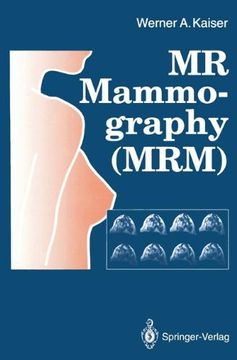 portada Mr Mammography (Mrm) (en Inglés)
