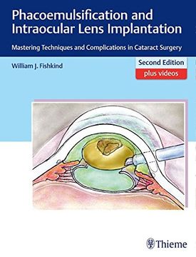portada Phacoemulsification and Intraocular Lens Implantation: Mastering Techniques and Complications in Cataract Surgery (en Inglés)