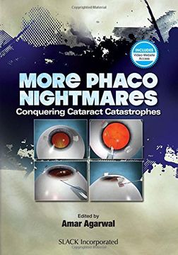 portada More Phaco Nightmares: Conquering Cataract Catastrophes (en Inglés)