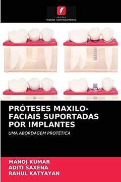 portada Próteses Maxilo-Faciais Suportadas por Implantes: Uma Abordagem Protética (en Portugués)