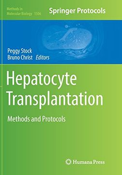 portada Hepatocyte Transplantation: Methods and Protocols (Methods in Molecular Biology) 
