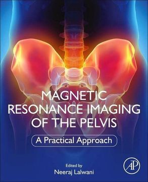 portada Magnetic Resonance Imaging of the Pelvis: A Practical Approach (en Inglés)