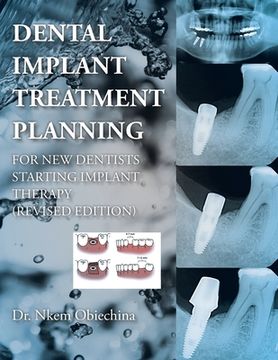 portada Dental Implant Treatment Planning for New Dentists Starting Implant Therapy (en Inglés)