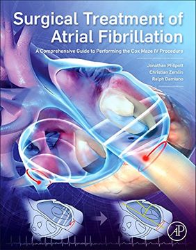 portada Surgical Treatment of Atrial Fibrillation: A Comprehensive Guide to Performing the Cox Maze IV Procedure