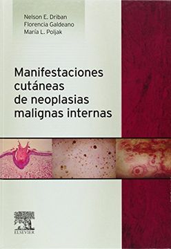portada Manifestaciones Cutáneas de Neoplasias Malignas Internas (in Spanish)