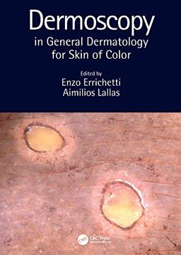 portada Dermoscopy in General Dermatology for Skin of Color (en Inglés)