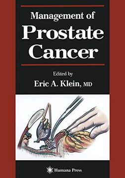 portada Management of Prostate Cancer (en Inglés)