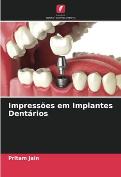 portada Impressões em Implantes Dentários