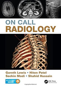 portada On Call Radiology