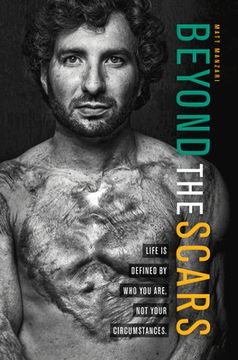 portada Beyond the Scars: Life Is Defined by Who You Are, Not Your Circumstances (en Inglés)