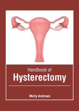 portada Handbook of Hysterectomy (en Inglés)