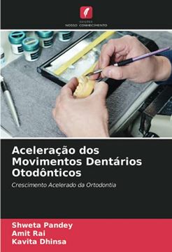 portada Aceleração dos Movimentos Dentários Otodônticos: Crescimento Acelerado da Ortodontia (en Portugués)