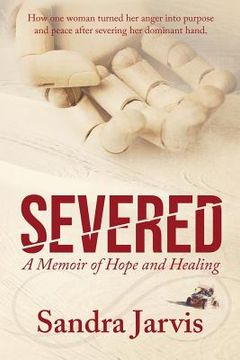 portada Severed: A Memoir of Hope and Healing (in English)
