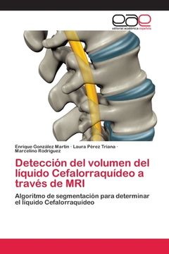 portada Detección del Volumen del Líquido Cefalorraquídeo a Través de mri (in Spanish)