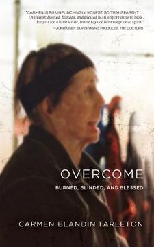 portada Overcome: Burned, Blinded, and Blessed (en Inglés)