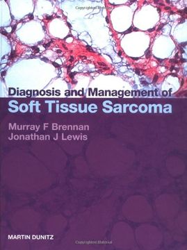 portada Diagnosis and Management of Soft Tissue Sarcoma (en Inglés)