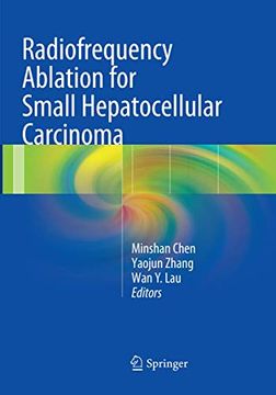 portada Radiofrequency Ablation for Small Hepatocellular Carcinoma (en Inglés)
