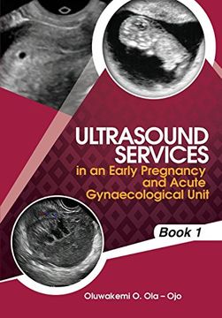 portada Ultrasound Services in An Early Pregnancy and Acute Gynaecological Unit