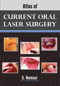 portada atlas of current oral laser surgery (en Inglés)