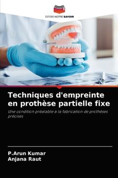 portada Techniques d'empreinte en prothèse partielle fixe (in French)