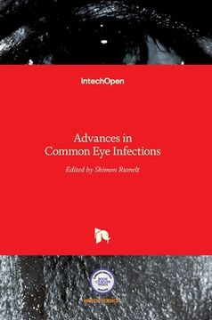 portada Advances in Common Eye Infections (en Inglés)