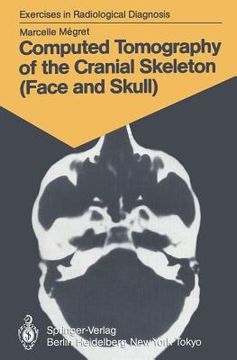 portada computed tomography of the cranial skeleton (face and skull): 58 radiological exercises for students and practitioners (en Inglés)
