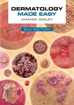 portada Dermatology Made Easy, Second Edition (en Inglés)