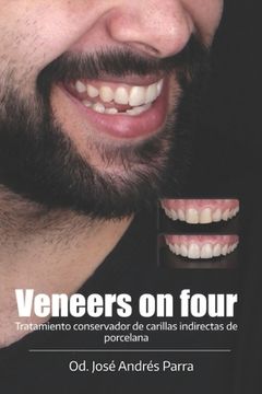 portada Veneers on four: Tratamiento conservador de carillas indirectas de porcelana