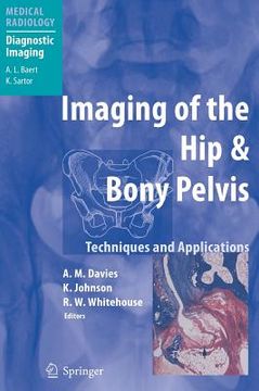 portada imaging of the hip & bony pelvis: techniques and applications (en Inglés)