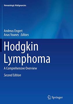 portada Hodgkin Lymphoma: A Comprehensive Overview (en Inglés)