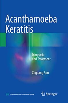 portada Acanthamoeba Keratitis: Diagnosis and Treatment (en Inglés)