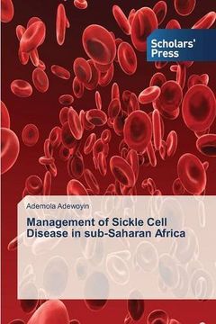portada Management of Sickle Cell Disease in sub-Saharan Africa