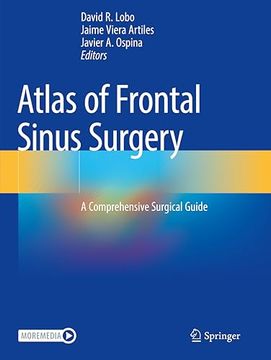 portada Atlas of Frontal Sinus Surgery: A Comprehensive Surgical Guide (en Inglés)