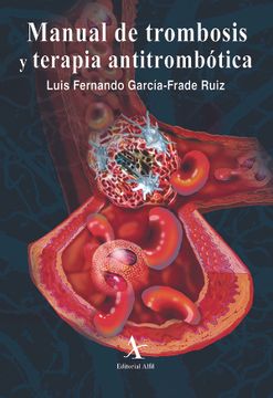 portada Manual de Trombosis y Terapia Antitrombótica (in Spanish)