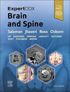 portada Expertddx: Brain and Spine 