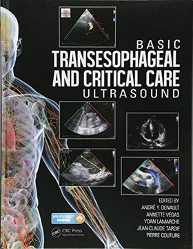 portada Basic Transesophageal and Critical Care Ultrasound (en Inglés)