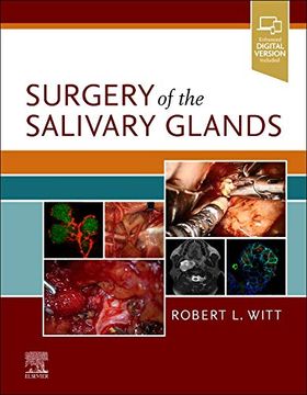 portada Surgery of the Salivary Glands (en Inglés)