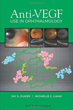 portada Anti-VEGF Use in Ophthalmology
