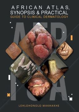 portada African Atlas, Synopsis & Practical Guide to Clinical Dermatology (in English)
