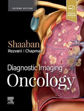 portada Diagnostic Imaging: Oncology, 2e (in English)