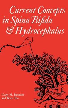portada Current Concepts in Spina Bifida and Hydrocephalus (en Inglés)