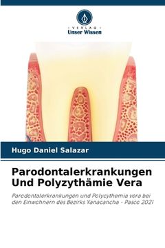 portada Parodontalerkrankungen Und Polyzythämie Vera (en Alemán)
