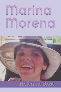 portada Marina Morena: Convivendo Com a Esclerose Tuberosa E a Síndrome de West