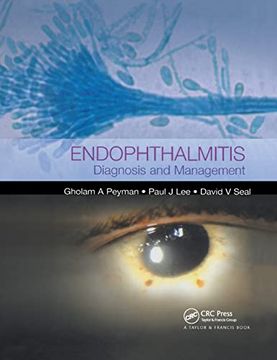 portada Endophthalmitis: Diagnosis and Treatment (en Inglés)