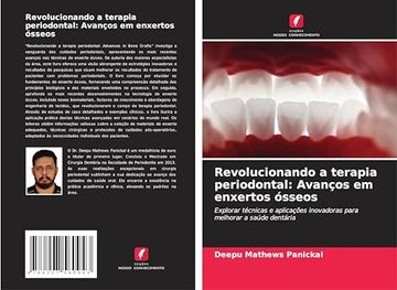 portada Revolucionando a Terapia Periodontal: Avanços em Enxertos Ósseos (en Portugués)