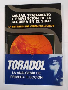 portada Causas, Tratamiento y Prevención de la Ceguera en el Sida: La Retinitis por Citomegalovirus.