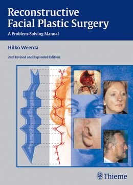 portada Reconstructive Facial Plastic Surgery: A Problem-Solving Manual